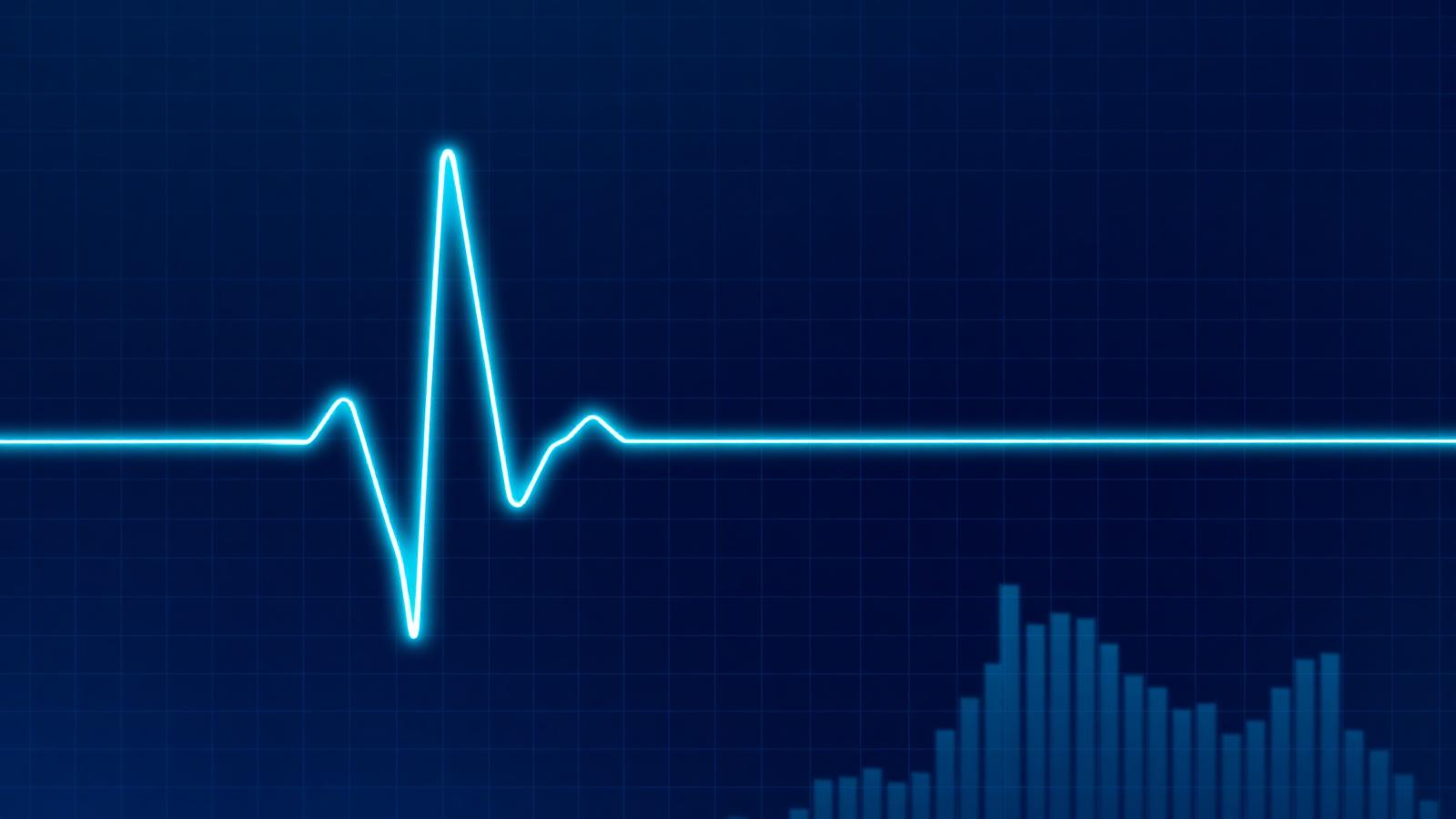 Linha de eletrocardiograma sobre gráfico financeiro, metáfora dos sinais vitais da empresa